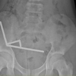 1761673249899-magnet-1761646311530_169