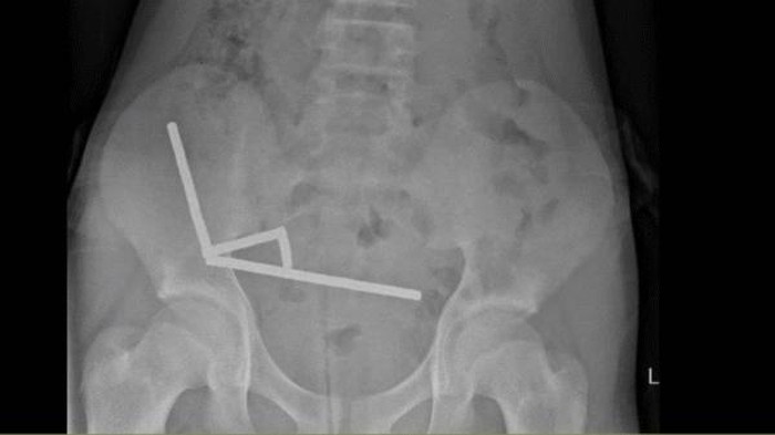 1761673249899-magnet-1761646311530_169